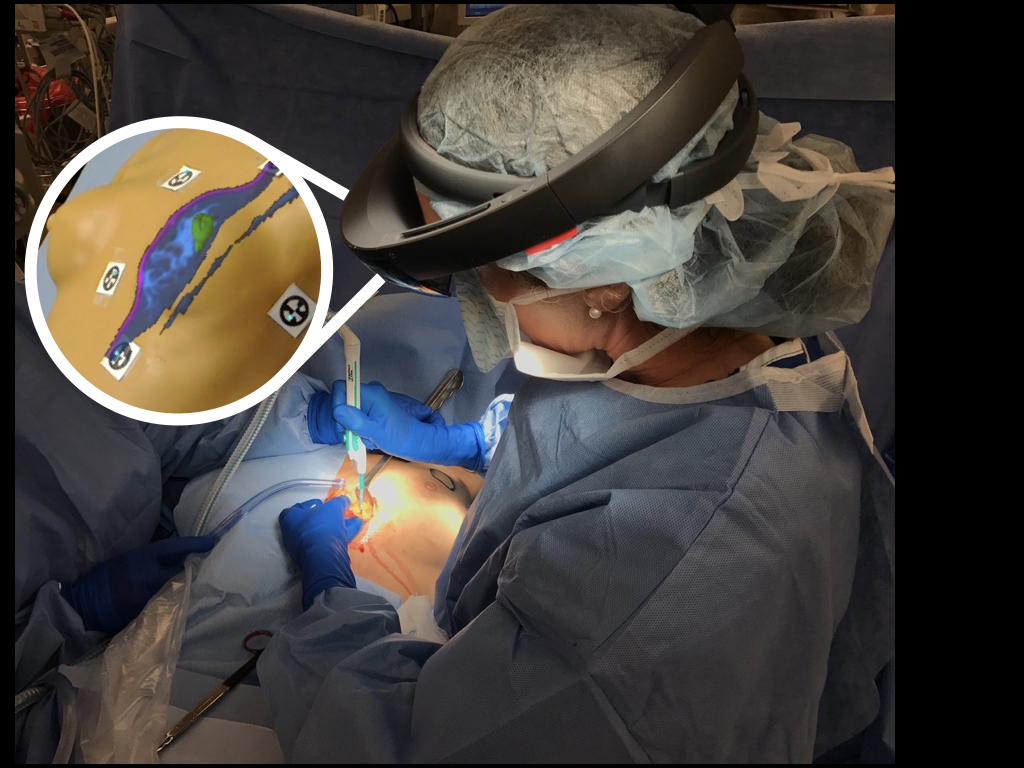 stanford-medicine-breast-surgery-reduction-0145.jpeg