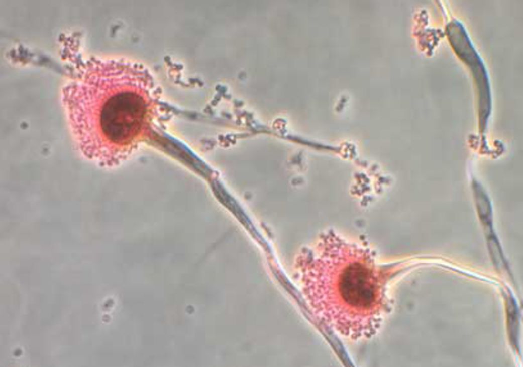 fungi-eats-inside-out-cnn-8027.jpeg
