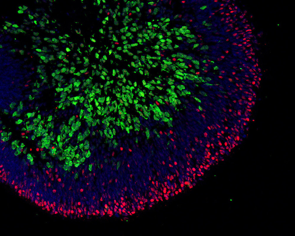 cells-organoid-growth-space-allocation-8607.png