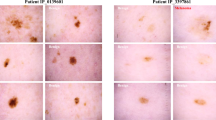 multimodal-ai-boosts-skin-condition-detection-1657.png
