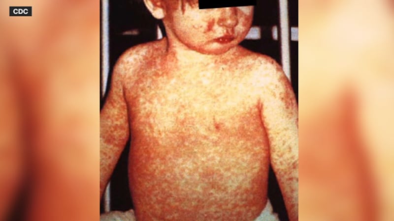 topeka-hospitals-lung-cancer-detection-tech-4558.jpeg
